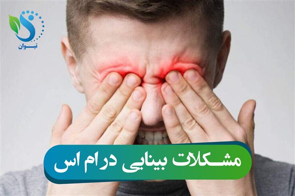 Tiwan Calf Device